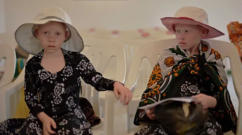 Carl de Souza/AFP/Getty Images Children with albinism need to wear hats and long sleeves to protect them from the harmful rays of the Sun (Credit: Carl de Souza/AFP/Getty Images)