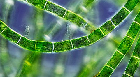 Blue-green algae cells, viewed through using electron microscoped