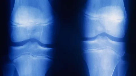 Alamy Microsoft's anechoic chamber is so quiet, you can reportedly hear the grinding of your own joints as you move (Credit Alamy)