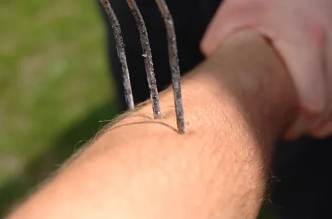 Alamy Negative emotions change how much empathy we feel towards those in pain (Credit: Alamy)