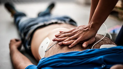 Getty Images Those who survive cardiac arrest are left with permanent heart failure (Credit: Getty Images)