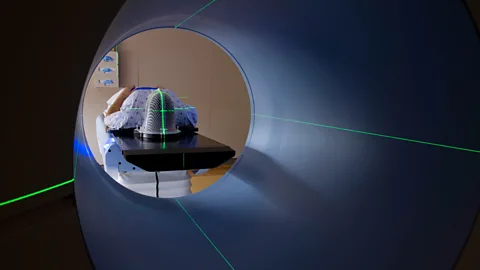 Getty Images To implant electrodes in the brain, scientists must first drill a small hole (Credit: Getty Images)