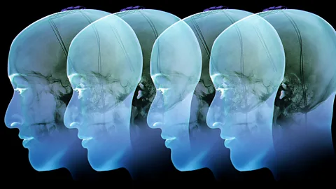 Science Photo Library The brain's reward centre is over-active in individuals with addiction disorders (Credit: Science Photo Library)