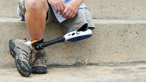 Getty Images There are thought to be as many as 40 million amputees around the world (Credit: Getty Images)