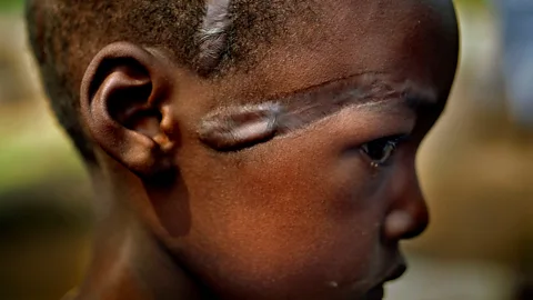 Getty Images Guns are hardly a prerequisite for conflict – as shown in this portrait of Console, a Hutu refugee scarred by a machete during the Rwandan genocide in 1994 (Credit: Getty Images)
