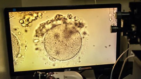 Getty Images A change in the law has allowed clinics to offer women the chance to freeze their eggs if they wish to postpone when they have children (Credit: Getty Images)