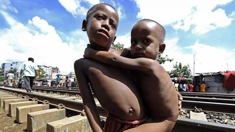 Getty Images Malnourishment as a child can lead to stunted growth and other health problems that linger throughout life (Credit: Getty Images)