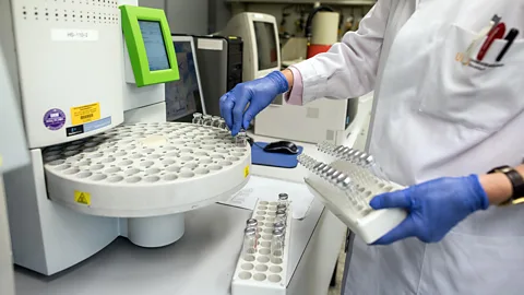 Alamy Gas chromatography is used for a variety of purposes; here, it is used to analyse blood alcohol levels at a lab in Germany (Credit: Alamy)