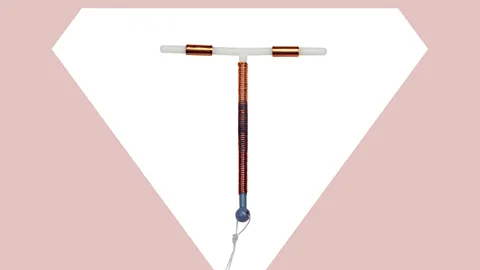 BBC/Getty The copper IUD paralyses and even decapitates sperm, making egg fertilisation highly unlikely (Credit: BBC/Getty)