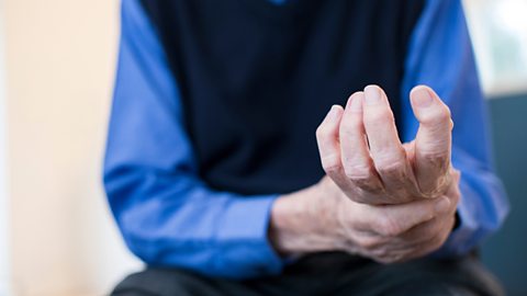 An elderly man is shown gripping his wrist, which is in pain from supposed arthritis.