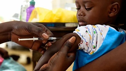 Getty Images Measles can lead to subacute sclerosing panencephalitis, the symptoms of which resemble nodding syndrome - another reason why vaccination is important (Credit: Getty Images)