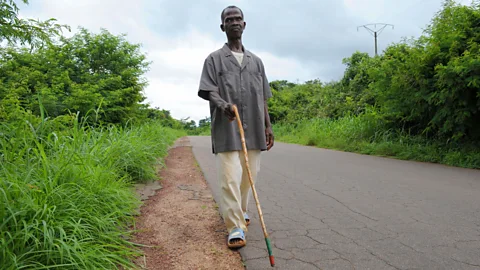 Getty Images Nodding syndrome was once thought to be caused by the same parasitic worms that also lead to river blindness (Credit: Getty Images)