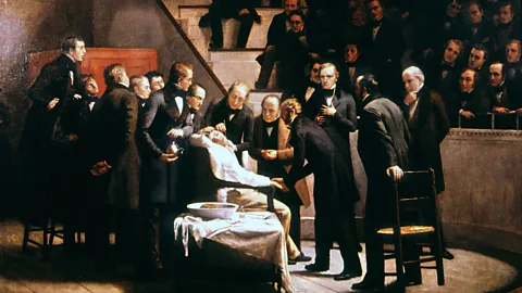 Alamy An illustration of the first demonstration of surgery under anaesthesia at Massachusetts General Hospital in 1846 (Credit: Alamy)