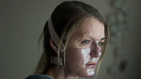 Viking Film/EMU Films Vicky Knight, who suffered third and fourth degree burns as a child, is making her acting debut in powerful new drama Dirty God (Credit: Viking Film/EMU Films)