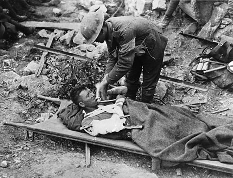 Photograph showing a First World War soldier with an arm splint