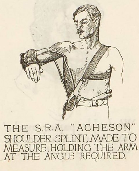 SRA pamphlet showing the 'Acheson' shoulder splint.