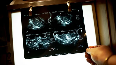 Getty Images US law and consulting firms were among the first to offer fertility benefits for staff (Credit: Getty Images)