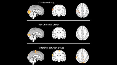 Image from study showing activation map in subjects.