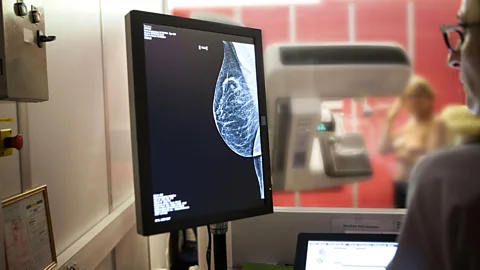 Getty Images The BRCA1 and BRCA2 genes have become indelibly associated with female breast cancer even though men carry them too (Credit: Getty Images)