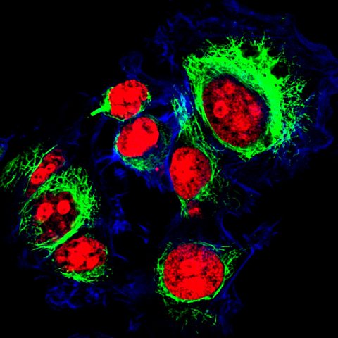 A picture of HeLa cells under the microscope