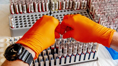 SOPA Images/Getty Images Its currently unclear exactly how accurate antibody tests are or how long antibodies remain in someone’s body (Credit: SOPA Images/Getty Images)