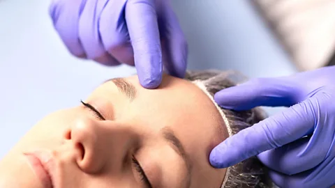 Alamy The Zoom Boom is driving interest in non-invasive facial procedures that correct lines caused by the facial expressions we notice on video calls (Credit: Alamy)