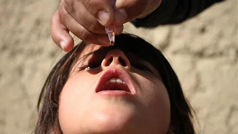Getty Images Afghanistan is one of the few places where polio has not yet been eradicated (Credit: Getty Images)