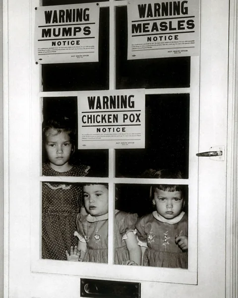 Alamy Occasionally, vaccinated people will inadvertently cause an outbreak of the Victorian-era illness mumps (Credit: Alamy)