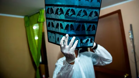 Ernesto Benavides/Getty Images Studying people who show unusual levels of resistance or susceptiblity to Covid-19 may lead to new treatments (Credit: Ernesto Benavides/Getty Images)