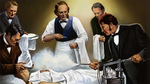 Joseph Lister using carbolic acid during an operation.