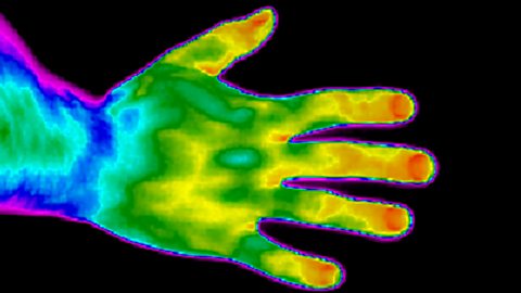 Thermographic image of hand