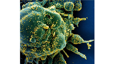 Getty Images In the future, Covid-19 booster doses might be updated each year to match the main viral variants in circulation, just like flu vaccines (Credit: Getty Images)