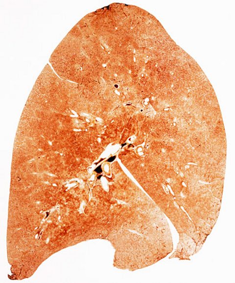 A section through a normal lung - pink and healthy