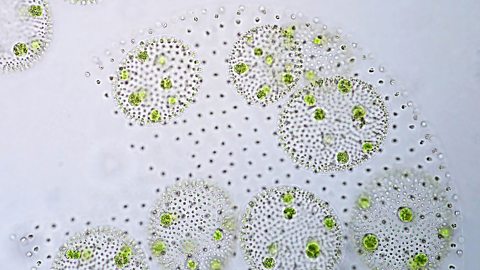 Phytoplankton viewed through a microscope.