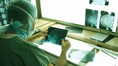 Getty Images It's thought that certain viruses can trigger an immune response which later increases the risk of a person developing Parkinson's disease (Credit: Getty Images)