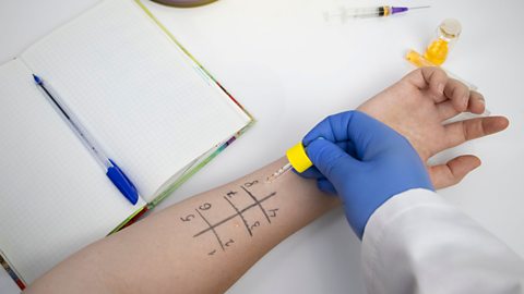 A person having food allergy testing on their arm, with droplets of an allergen placed on their arm