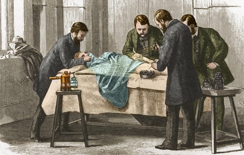 An engraving depicting Joseph Lister spraying antiseptic over the wound while doctors perform an operation.