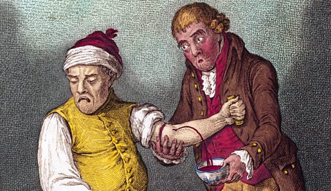 Breathing a Vein, by James Gillray, 1804. Gillray's cartoon shows a doctor drawing blood from a patient's vein in the belief that it will restore balance to his body systems. 