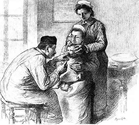 Late 19th century engraving of a doctor treating a young child.