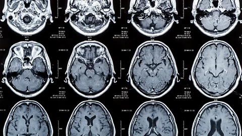 Getty Images The human brain undergoes a number of changes as we age (Credit: Getty Images)