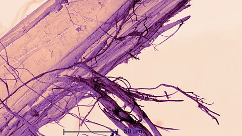 Alamy A scanning electron micrograph of asbestos fibres (Credit: Alamy)
