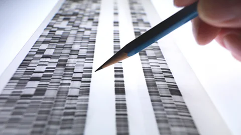 Getty Images A scientist viewing a DNA gel (Credit: Getty Images)