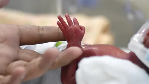 Getty Images Babies born around 22 weeks face huge challenges and have to receive round-the-clock intensive care (Credit: Getty Images)