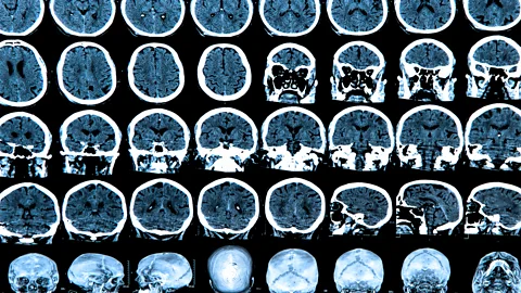 p0jv79nb.jpg The cells that protect your brain against infection could also be behind some chronic diseases