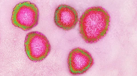 Getty Images Like the coronaviruses that cause the common cold, some scientists have predicted that Covid-19 will evolve into a mild infection (Credit: Getty Images)