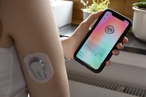 sensor attached to skin showing level of glucose in a person’s blood and displays this on a smart phone app
