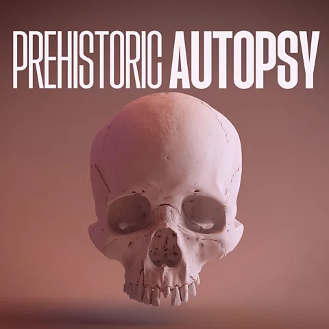 Prehistoric Autopsy