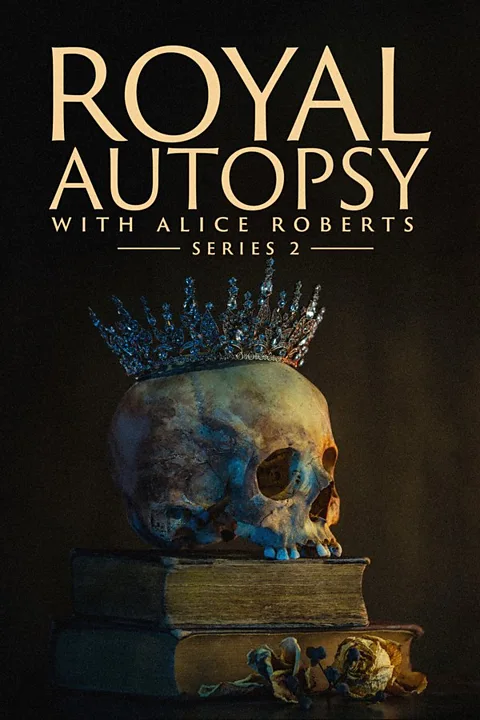 Royal Autopsy with Alice Roberts