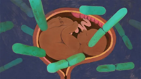 Prashanti Aswani The presence of Lactobacillus crispatus in the vaginal microbiome is associated with a lower risk of preterm delivery (Credit: Prashanti Aswani)