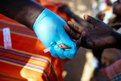 Kang-Chun Cheng Ochieng uses a rapid antigen test to help him diagnose people with visceral leishmanaisis (Credit: Kang-Chun Cheng)